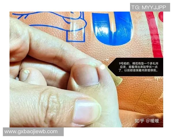 足球明星因甲沟炎困扰赛季表现专家解析病因与康复之道